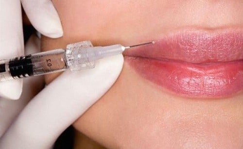 Методы коррекции и увеличения губ