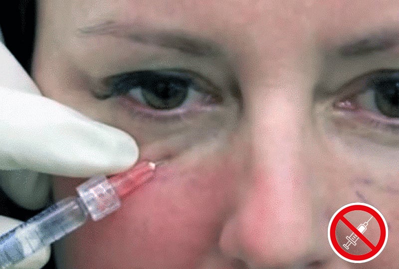Как убрать отек с глаз косметолог